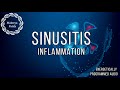 Sinusitis Treatment Instant Relief and Healing / Energetically Programmed Audio / Maitreya Reiki™