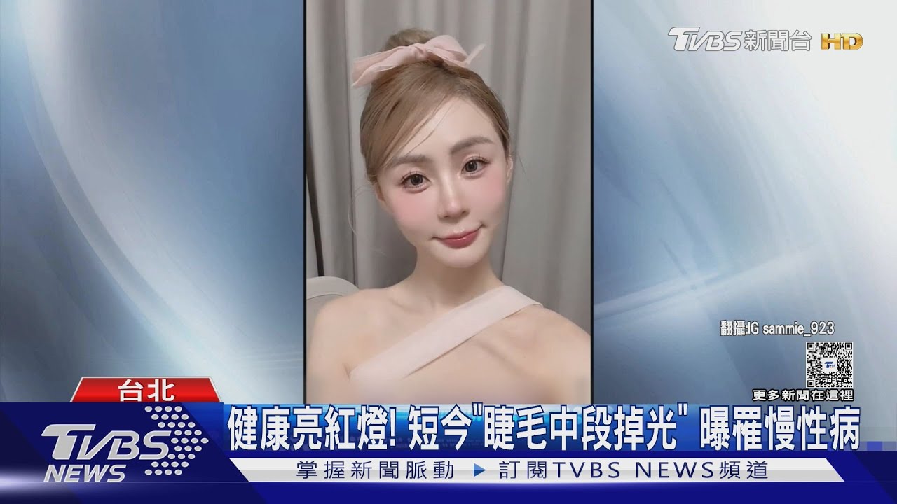 短今右眼睫毛「中段掉光」！就醫揪慢性病　醫曝常見原因