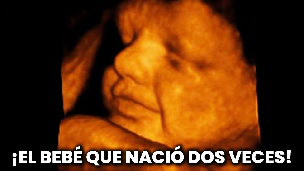 SACÓ un BEBÉ de un VIENTRE! Le QUITÓ un TUMOR y luego lo VOLVIÓ a METER para que pudiera NACER!