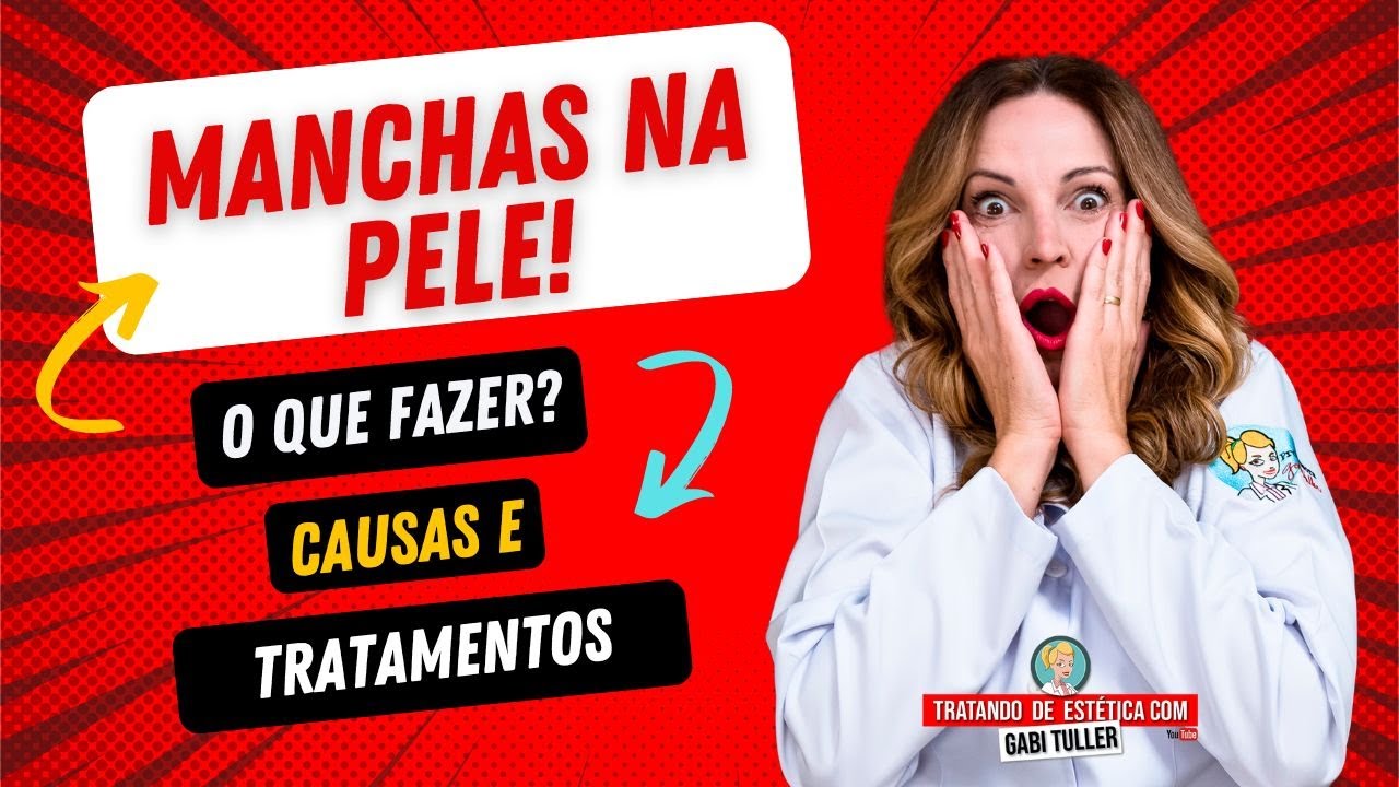 Manchas na Pele! O que fazer? Como identificá-las e como tratá-las? | Gabi Tuller