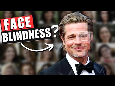 Do You Have Face Blindness!? (Prosopagnosia Explained)