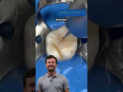 Small filling due to a small cavity #shorts