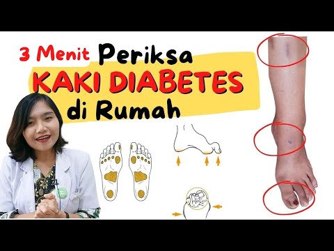 HOW TO EXAMINE DIABETES FEET AT HOME. ONLY 3 MINUTES!