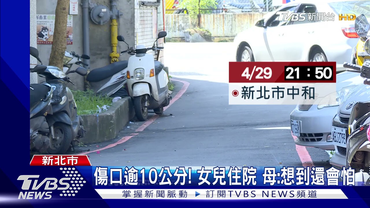 鄰居愛犬「沒綁繩」！女童遭狠咬　傷口長逾10公分見骨