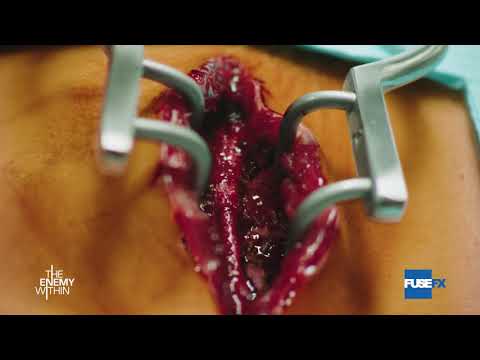 FuseFX: The Enemy Within (VFX Breakdown)