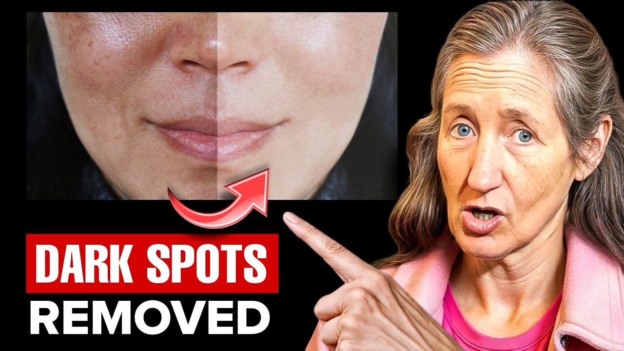 Best Remedy for Hyperpigmentation | Barbara O'Neill