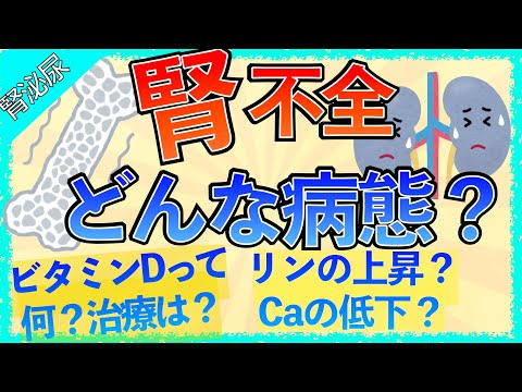 カルシデス・オセラトゥス