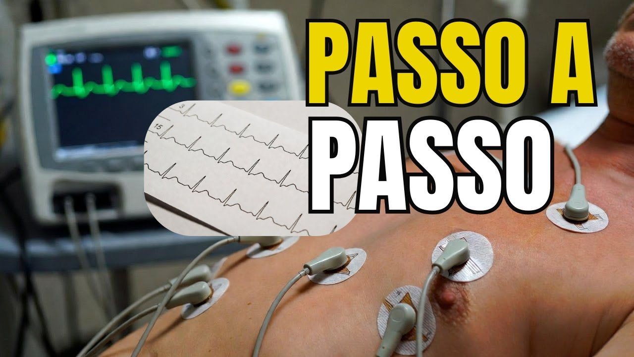 COMO realizar um Eletrocardiograma (ECG) corretamente? #nasctreinamentosenfermagem #enfermagem
