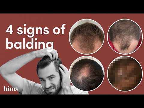 Hims video/presentation/materials