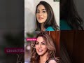 Nikki Tamboli Face Transformation Nikkitamboli Plasticsurgery Botoxfiller Beautyinspiration