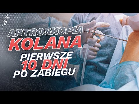 Artroskopia kolana - pierwsze 10 dni po zabiegu. Jacek Jaroszewski vlog.