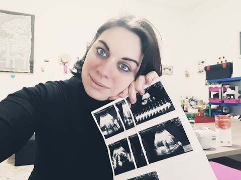 Cè dolore in un comune e poi Il costo di sostituzione dellanca Nizhny Novgorod