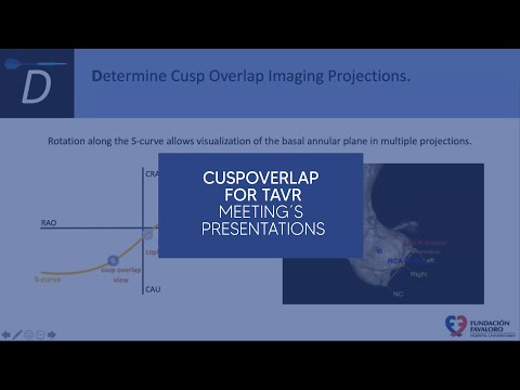 CuspOverlap for TAVR - Meeting´s  Presentations
