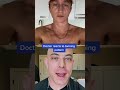 Doctor Reacts To Tan Lines Sun Spf