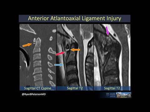 Trauma: Beyond the Basics - Neuroradiology Longitudinal Course Sample