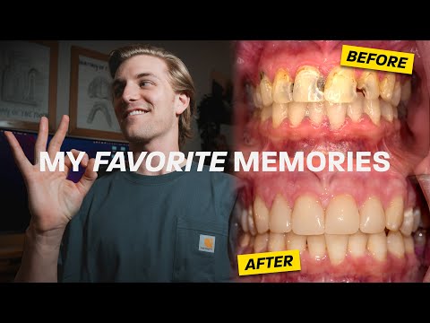 3個讓牙醫之路「值得」的瞬間！ (3 Moments That Made Dental School WORTH IT)