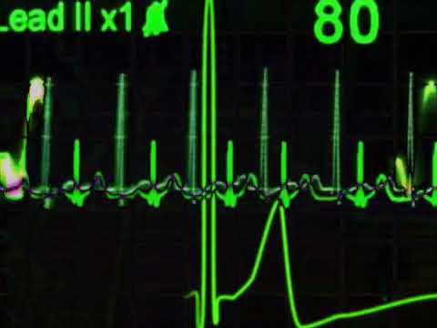 H33RA x CVIRO & GXNXVS - Cardiac [Visualiser]