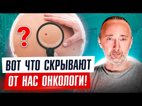 7 причин МЕЛАНОМЫ! Особый осмотр, защита и лечение от РАКА кожи! ЭТО скрывают от нас онкологи!