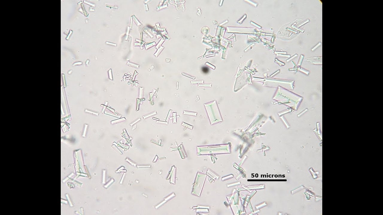 Complete RV Holding Tank Deep Clean Service