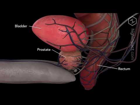 massaggio prostatico con prostatite cronica y