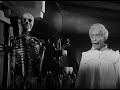 RESORTES MUERTOS DE RISA