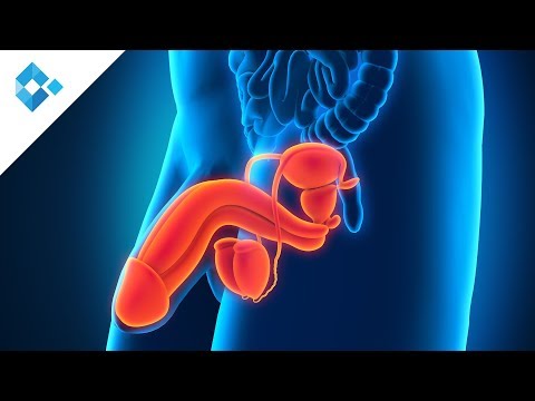 Rassosat Fibrose in der Prostata Tanne Wasser mit Prostata-Adenom