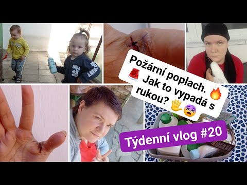 Týdenní vlog #20 Požární poplach. 🔥🚨 Jak to vypadá s rukou? 🖐️😵