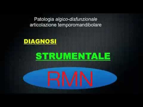 Tipi di intervento chirurgico al ginocchio Articolazioni Honda