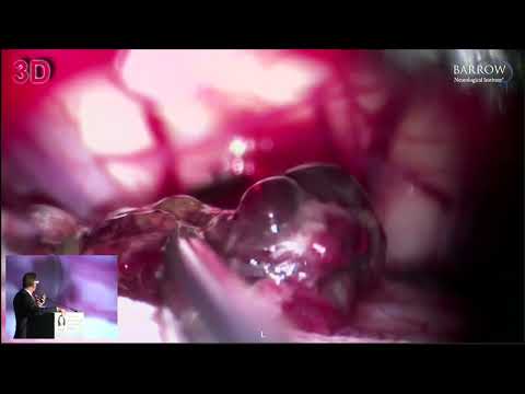 download lagu mp3 mp4 Aaron Smith Neurosurgeon, download lagu Aaron Smith Neurosurgeon gratis, unduh video klip Aaron Smith Neurosurgeon