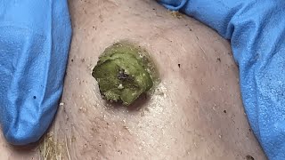 Download lagu 𝑻𝒉𝒆 𝑩𝒆𝒔𝒕 𝑨𝒄𝒉𝒊𝒆𝒗𝒆 𝑰𝒏𝒏𝒆𝒓 𝑷𝒆𝒂𝒄𝒆 𝑾𝒊𝒕𝒉 𝑻𝒉𝒆𝒔𝒆 𝑭𝒂𝒄𝒊𝒂𝒍 𝑪𝒍𝒆𝒂𝒏𝒔𝒊𝒏𝒈 #700151 mp3 Download lagu 𝑻𝒉𝒆 𝑩𝒆𝒔𝒕 𝑨𝒄𝒉𝒊𝒆𝒗𝒆 𝑰𝒏𝒏𝒆𝒓 𝑷𝒆𝒂𝒄𝒆 𝑾𝒊𝒕𝒉 𝑻𝒉𝒆𝒔𝒆 𝑭𝒂𝒄𝒊𝒂𝒍 𝑪𝒍𝒆𝒂𝒏𝒔𝒊𝒏𝒈 #700151 mp3