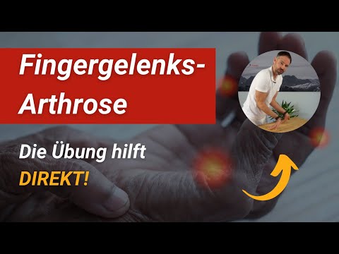 Selbstbehandlung bei Fingergelenks-Arthrose: Diese Übung hilft Dir direkt! ➡️ (nur 2 Minuten / Tag)
