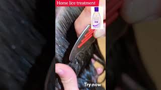 ivrea lice shampoo #headliceremoval #licetreatment