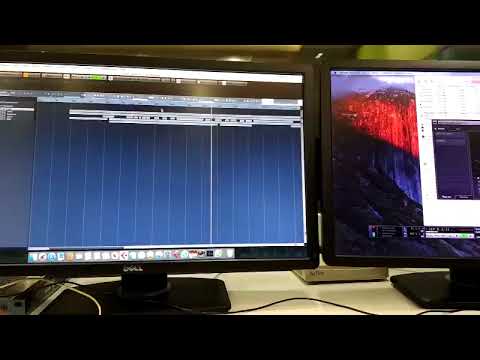 Can dediğin nedir kardaş? Allah için vermeyince..