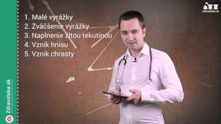 Astigmatizmus
