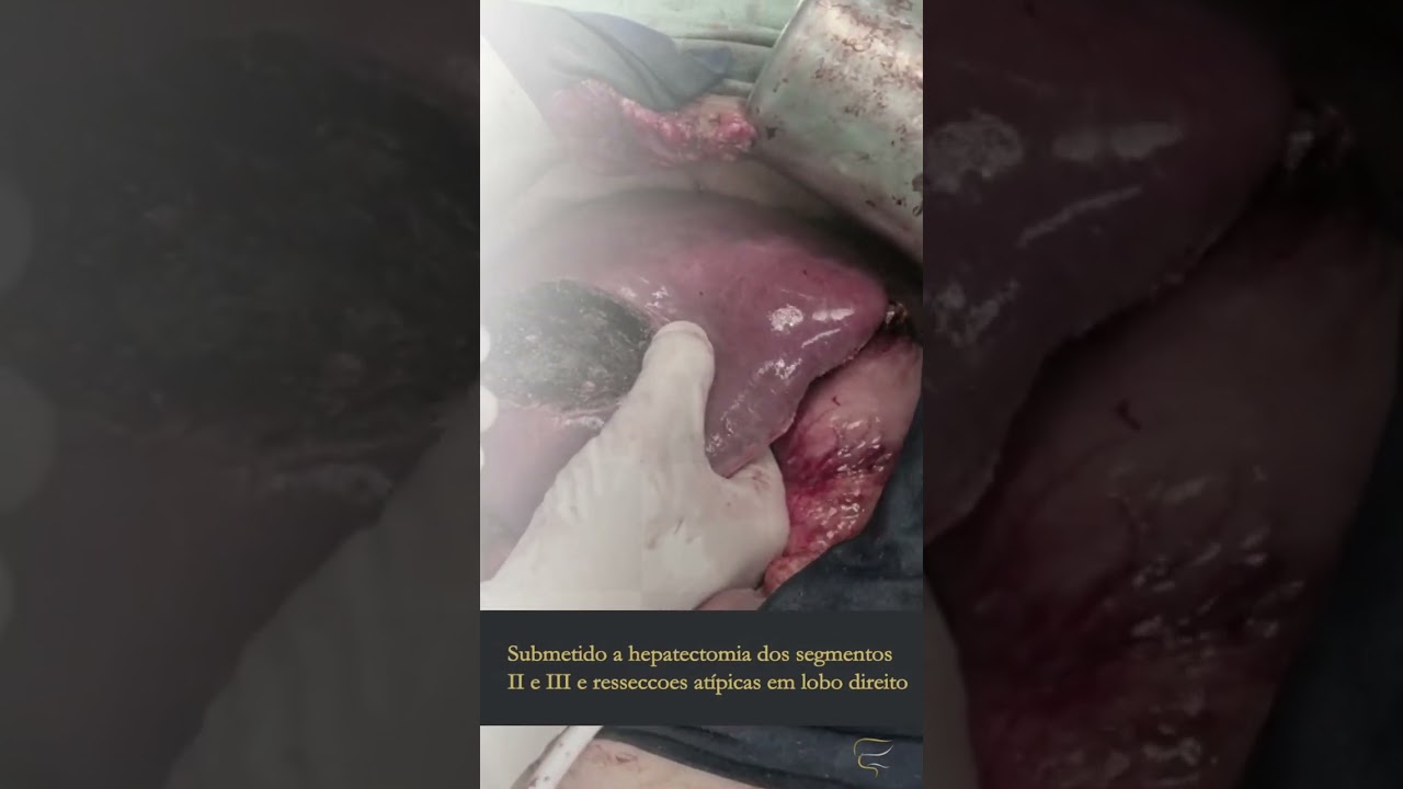 Pablo Duarte Rodrigues-16