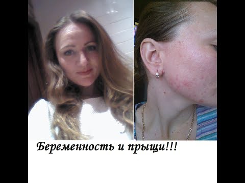 Сколько дней можно колоть диклофенак при остеохондрозе Узи коленного сустава в спб где сделать