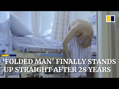 Mother Cries As Son Stands Up For the 1st Time in 28 Years