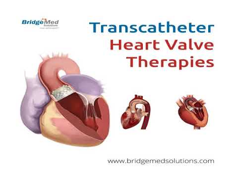 Viral Inactivation For TMVR Valve