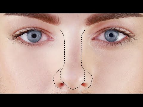 Joseph Harwood’s Non-Surgical Rhinoplasty at botonics