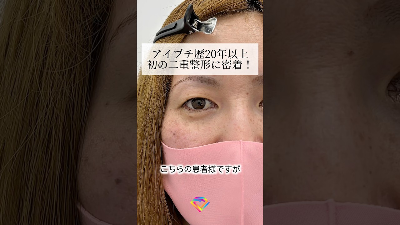 Youtubeのサムネイル