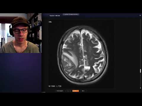 How to use Radiopaedia to teach