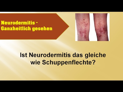 Was wenn bei mir das Ekzem zu machen Die Gele für proresywanija der Zähne bei atopitscheskom die Hautentzündung