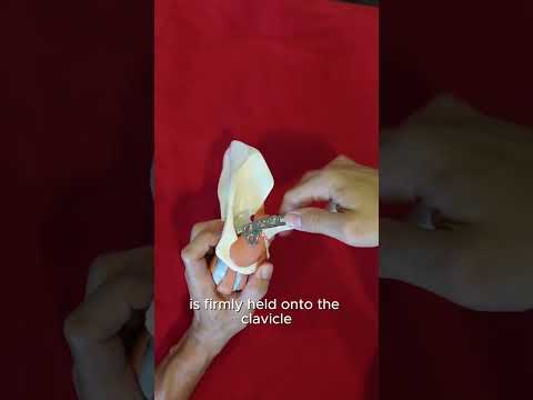 Distal Clavicle Fracture Explained in 60 Seconds!