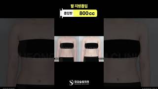 팔라인 차이 꽤 큰데?
