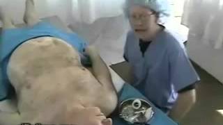 Cadáver se mueve en plena autopsia (Rigor Mortis)