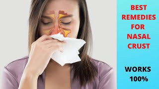 SCABS IN THE NOSE|Nasal crust treatment|Nasal crust removal[2020]