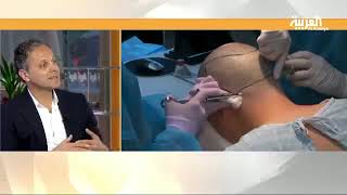 Hair Transplant - Al Arabiya