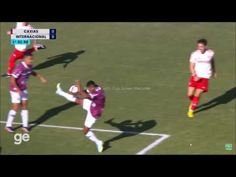CAXIAS 1 X 1 INTERNACIONAL  MELHORES MOMENTOS  SEMIFINAL CAMPEONATO GAÚCHO
