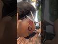 Ear Chopped from Haircut