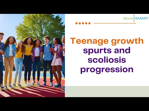 Teen Growth Spurts & Scoliosis Progression | What Every Parent Should Know #ScoliosisProgression